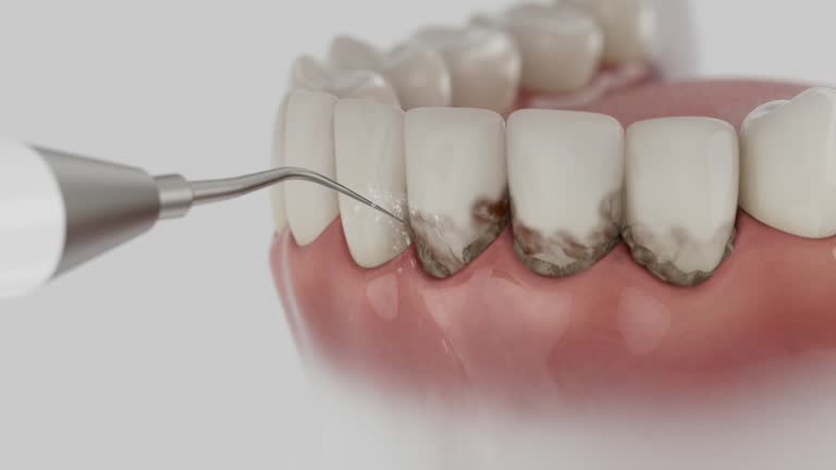 Trusted Teeth Cleaning And Checkup service in Roundup, MT - Dentist Open Now